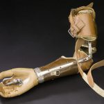 L’histoire des prothèses en 10 images
