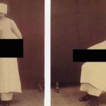 Les 10 images médicales historiques les plus perturbantes jamais vues -2