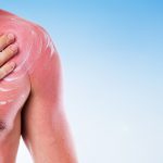 10 raisons de ne jamais mettre de crème solaire, parce que c’est beau la peau rouge