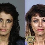 17 photos avant/après qui montrent les ravages de la drogue dure – 2